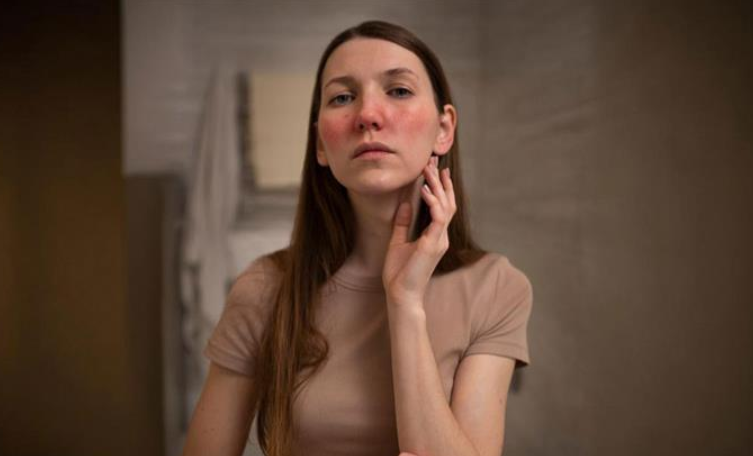 How to Stop Compulsive Skin Picking: Practical Strategies for Immediate Relief and Long-Term Recovery