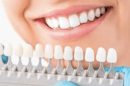 Why Cosmetic Dentistry Improves More Than Just Your Smile