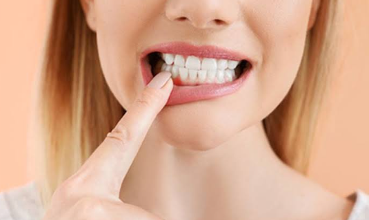 Gum Contouring For Aesthetics: How Dentists Reshape A Smile Safely