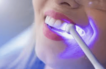 Why Cosmetic Dentists Focus On Both Form And Function