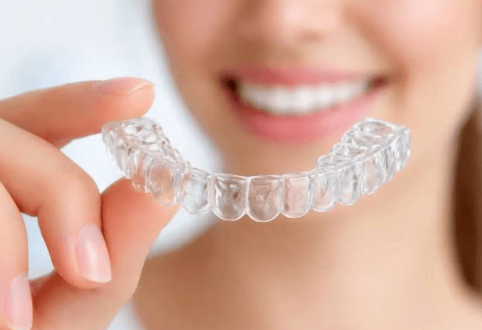 The Role Of Incremental Adjustments In Clear Aligner Success