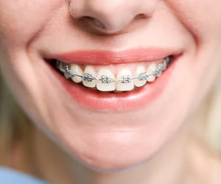 5 Ways Orthodontics Improve Both Function And Aesthetics