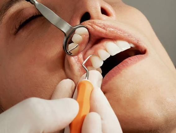 How Dentin Hypersensitivity Changes The Choice Of Dental Whitening And Bonding Techniques